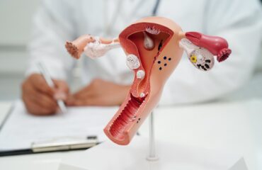 Uterus, doctor holding human anatomy model for study diagnosis a